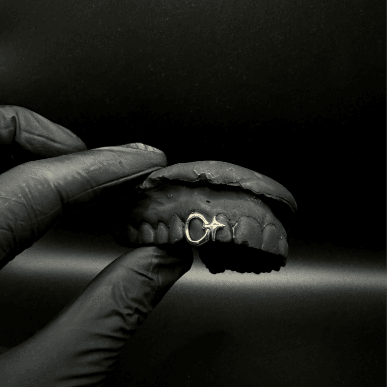 Glint Grill | 18k Gold