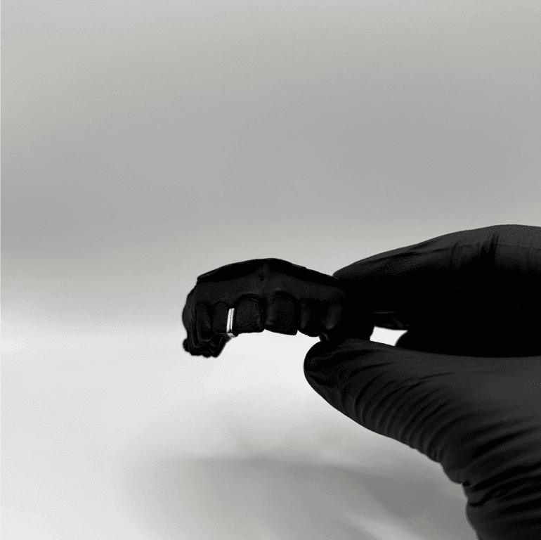 Gap Grill | 18k Gold